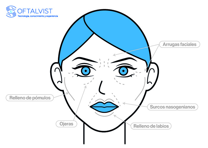 Beneficios del ácido hialurónico en rostro