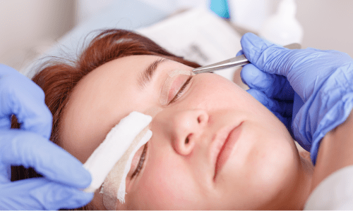 eyelids surgery