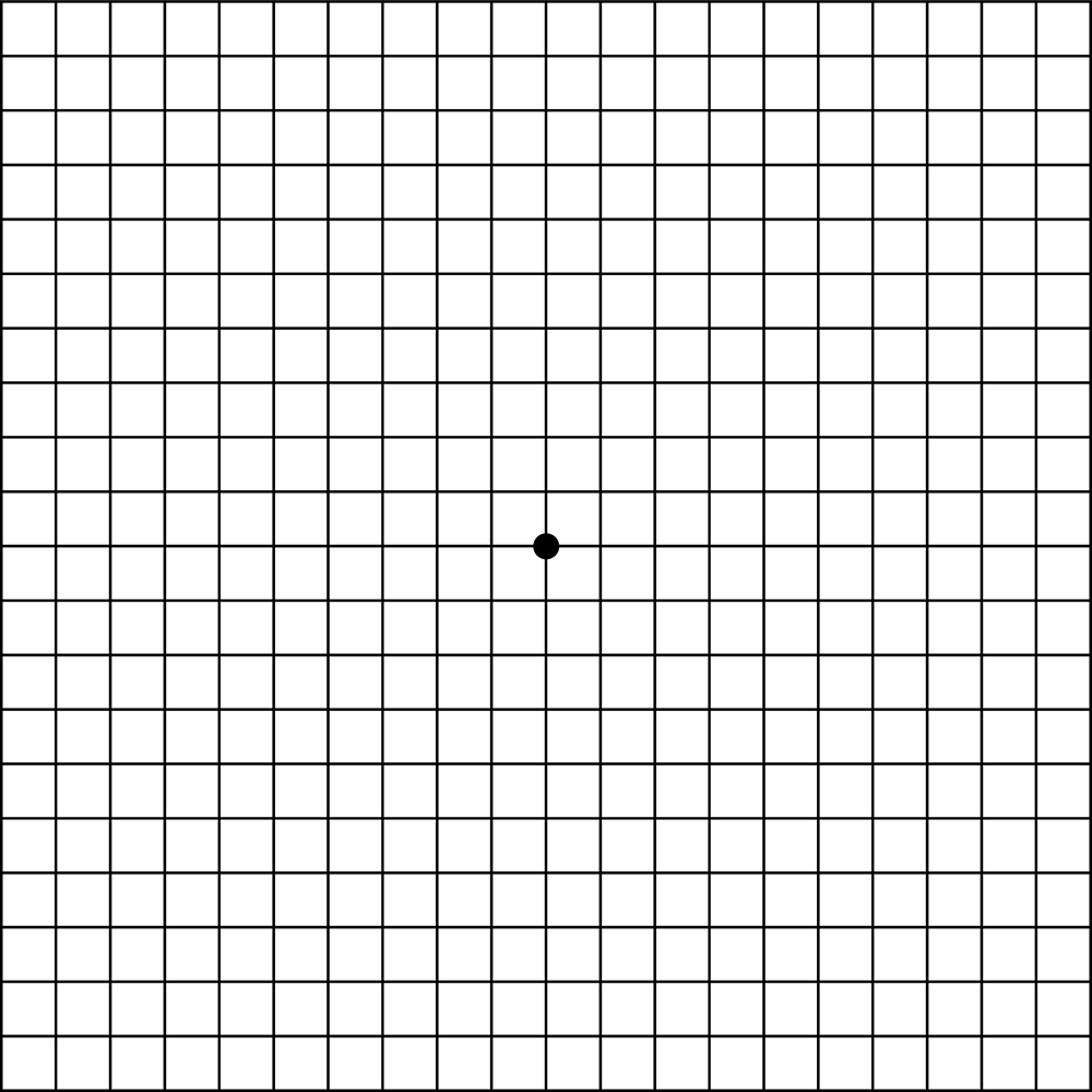 degeneracion-macular2